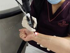 Elite+ Laser (Hair Removal)